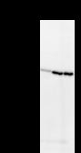 HELQ / HEL308 Antibody - Detection of HEL308 by Western blot. Samples: Whole cell lysate from human HEK293 (H, 25 ug) , mouse NIH3T3 (M, 25 ug) and rat F2408 (R, 25 ug) cells. Predicted molecular weight: 124 kDa