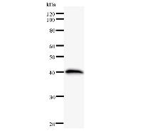 HELQ / HEL308 Antibody - Western blot analysis of immunized recombinant protein, using anti-HEL308 monoclonal antibody.