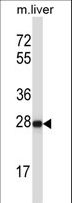 HELT Antibody - HELT Antibody western blot of mouse liver tissue lysates (35 ug/lane). The HELT antibody detected the HELT protein (arrow).