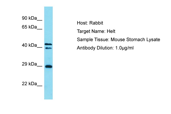 HELT Antibody -  This image was taken for the unconjugated form of this product. Other forms have not been tested.