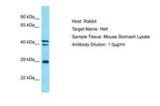 HELT Antibody -  This image was taken for the unconjugated form of this product. Other forms have not been tested.