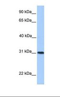 HELT Antibody - MCF7 cell lysate. Antibody concentration: 1.0 ug/ml. Gel concentration: 12%.  This image was taken for the unconjugated form of this product. Other forms have not been tested.