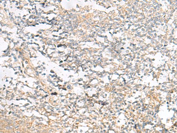 HELT Antibody - Immunohistochemistry of paraffin-embedded Human tonsil tissue  using HELT Polyclonal Antibody at dilution of 1:40(×200)