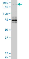 HELZ Antibody - HELZ monoclonal antibody (M02), clone 5B2 Western blot of HELZ expression in HeLa NE.