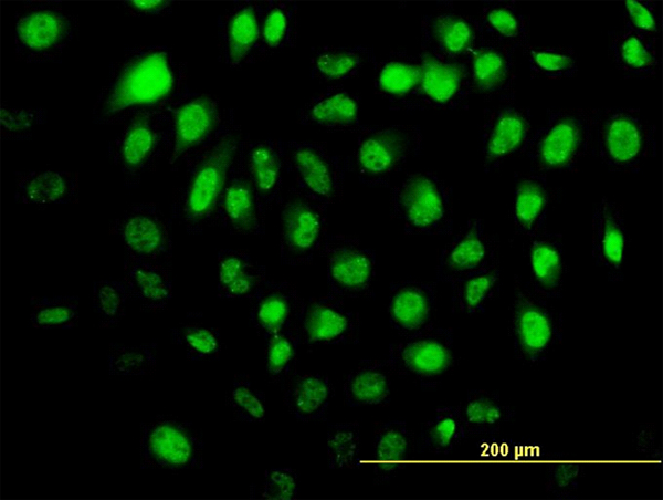 HELZ Antibody - Immunofluorescence of monoclonal antibody to HELZ on HeLa cell. [antibody concentration 10 ug/ml]