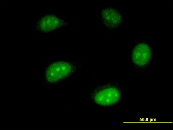 HEM45 / ISG20 Antibody - Immunofluorescence of monoclonal antibody to ISG20 on HeLa cell . [antibody concentration 10 ug/ml]