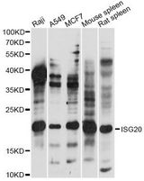 HEM45 / ISG20 Antibody - Western blot analysis of extracts of various cell lines, using ISG20 antibody at 1:1000 dilution. The secondary antibody used was an HRP Goat Anti-Rabbit IgG (H+L) at 1:10000 dilution. Lysates were loaded 25ug per lane and 3% nonfat dry milk in TBST was used for blocking. An ECL Kit was used for detection and the exposure time was 10s.
