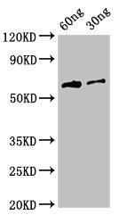Hemagglutinin Antibody - Western Blot Positive WB detected in Recombinant protein All lanes: HA antibody at 3µg/ml Secondary Goat polyclonal to rabbit IgG at 1/50000 dilution predicted band size: 64 kDa observed band size: 64 kDa