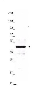 Hemagglutinin / HA Tag Antibody - Anti-HA Epitope Tag Antibody - Western Blot. Anti-HA epitope tag polyclonal antibody detects HA-tagged recombinant proteins by western blot. Polyclonal Rabbit anti-HA epitope tag, at a 1:2000 dilution, was used to detect 1.0 ug of 12-Epitope Tag Protein Marker Lysate (MB- containing the HA epitope tag. A 4-20% gradient gel was used to resolve the protein by SDS-PAGE. The lysate was transferred to nitrocellulose using standard methods. After blocking, the membrane was probed with anti-HA tag antibody for 1 h at room temperature followed by washes and reaction with a 1:20000 dilution of IRDye 800 conjugated Gt-a-Rabbit IgG (H&L) MX10 (code for 30 min at room temperature. LICORs Odyssey Infrared Imaging System was used to scan and process the image. Other detection systems will yield similar results.