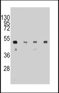 Hemagglutinin / HA Tag Antibody - Western blot of anti-HA Tag Antibody in 12tag recombinant protein. 12tag recombinant protein was detected using the purified antibody.