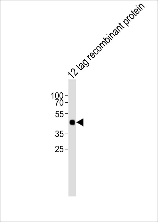 Hemagglutinin / HA Tag Antibody - Western blot of lysate from 12 tag recombinant protein cell line, using Tag-HA. 2x Antibody. Antibody was diluted at 1:1000. A goat anti-rabbit IgG H&L (HRP) at 1:5000 dilution was used as the secondary antibody. Lysate at 35ug.