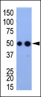 Hemagglutinin / HA Tag Antibody - Western blot of anti-HA tag antibody in HA-tagged recombinant protein bacterial lysate.