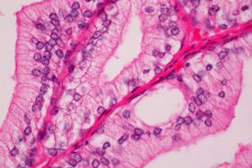 Product - Prostate section stained with Hematoxylin & Eosin Stain Kit (cytoplasm, pink; nuclei, blue).
