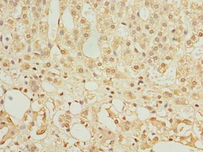HEMK1 Antibody - Immunohistochemistry of paraffin-embedded human adrenal gland tissue using antibody at dilution of 1:100.
