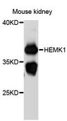 HEMK1 Antibody - Western blot analysis of extracts of mouse kidney, using HEMK1 antibody at 1:3000 dilution. The secondary antibody used was an HRP Goat Anti-Rabbit IgG (H+L) at 1:10000 dilution. Lysates were loaded 25ug per lane and 3% nonfat dry milk in TBST was used for blocking. An ECL Kit was used for detection and the exposure time was 30s.