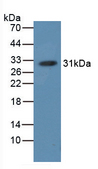 Hemoglobin Antibody