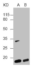 Hemoglobin Antibody - All Lanes: Mouse anti human hemoglobin Monoclonal antibody at 1ug/ml Lane A: Hemoglobin from human whole blood Lane B: Human serum Secondary Goat polyclonal to Mouse IgG at 1/5000 dilution Predicted band size: 14kd Observed band size: 14KD