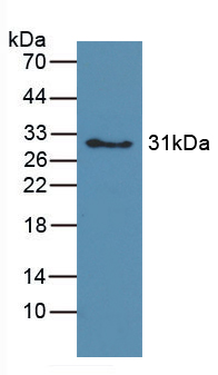 Hemoglobin Antibody