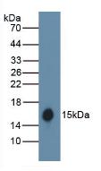 Hemoglobin Antibody