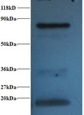 Hemoglobin Antibody - Western blot of Hemoglobin polyclonal Antibody at 2 ug/ml + 293T whole cell lysate at 20 ug. Secondary: Goat polyclonal to Rabbit IgG at 1:15000 dilution. Predicted band size: 16 kDa. Observed band size: 16 kDa Additional bands at: 30 kDaï¼Œ80 kDa. We are unsure as to the identity of these extra bands.  This image was taken for the unconjugated form of this product. Other forms have not been tested.
