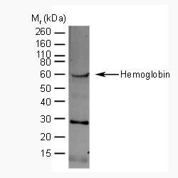 Hemoglobin Antibody - Human hemoglobin detected in a red blood cell lysate using Sheep anti-Human Hemoglobin . (Other bands detected represent different subunits of hemoglobin)
