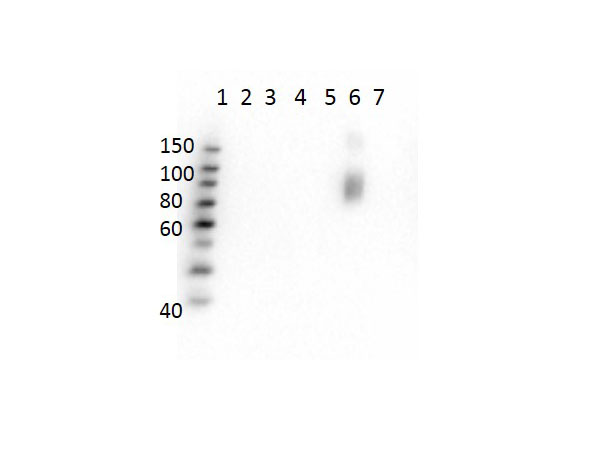 Hemoglobin beta S Antibody - Western Blot of Mouse Anti-Hemoglobin beta S Antibody. Lane 1: Molecular Weight Ladder. Lane 2: HbA peptide conjugated to BSA. Lane 3: HbA-2 peptide conjugated to BSA. Lane 4: HbC peptide conjugated to BSA. Lane 5: HbF peptide conjugated to BSA. Lane 6: HbS peptide conjugated to BSA. Lane 7: BSA alone. Load: 50ng per lane. Primary antibody: Anti-HbS antibody at 1µg/mL overnight at 4°C. Secondary antibody: Rabbit Anti-Mouse secondary antibody at 1:40,000 for 30 min at RT. Block: MB-073 for 30 min RT. Predicted/Observed: Reactivity seen in Lane 6 specific to HbS only.