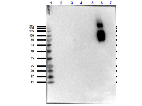 Hemoglobin beta S Antibody - Western blot results of Mouse Anti-HbS Antibody. Lane 1: Opal Prestained molecular weight ladder - MB-210-0500. Lane 2: HbA. Lane 3: HbA2. Lane 4: HbC. Lane 5: HbF. Lane 6: HbS. Lane 7: BSA. Loaded 10ug. Blocking: BlockOut Universal buffer - MB-073 for 30 min at RT. Primary Antibody: Anti-Hemoglobin beta S at 1:1000 overnight at 4°C. Secondary Antibody: Rabbit Anti-Mouse HRP at 1:40,000 for 30 min at RT.