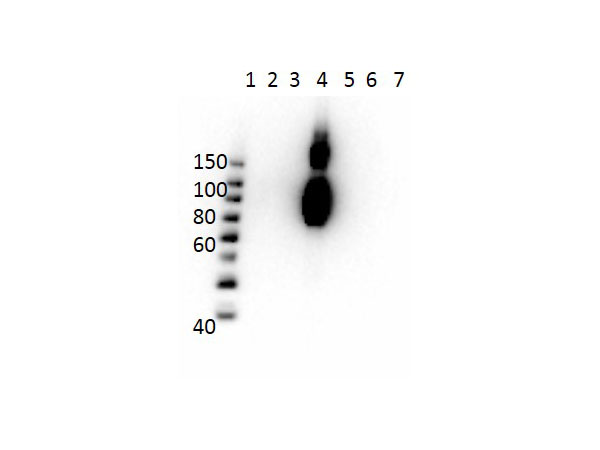 Hemoglobin C Antibody - Western Blot of Mouse Anti-Hemoglobin beta C Antibody. Lane 1: Molecular Weight Ladder. Lane 2: HbA peptide conjugated to BSA. Lane 3: HbA-2 peptide conjugated to BSA. Lane 4: HbC peptide conjugated to BSA. Lane 5: HbF peptide conjugated to BSA. Lane 6: HbS peptide conjugated to BSA. Lane 7: BSA alone. Load: 50ng per lane. Primary antibody: Anti-HbC antibody at 1µg/mL overnight at 4°C. Secondary antibody: Rabbit Anti-Mouse secondary antibody at 1:40,000 for 30 min at RT. Block: MB-073 for 30 min RT. Predicted/Observed: Reactivity seen in Lane 4 specific to HbC only.