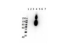 Hemoglobin C Antibody - Western Blot of Mouse Anti-Hemoglobin beta C Antibody. Lane 1: Molecular Weight Ladder. Lane 2: HbA peptide conjugated to BSA. Lane 3: HbA-2 peptide conjugated to BSA. Lane 4: HbC peptide conjugated to BSA. Lane 5: HbF peptide conjugated to BSA. Lane 6: HbS peptide conjugated to BSA. Lane 7: BSA alone. Load: 50ng per lane. Primary antibody: Anti-HbC antibody at 1µg/mL overnight at 4°C. Secondary antibody: Rabbit Anti-Mouse secondary antibody at 1:40,000 for 30 min at RT. Block: MB-073 for 30 min RT. Predicted/Observed: Reactivity seen in Lane 4 specific to HbC only.