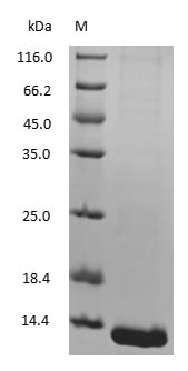 Hemoglobin Protein - (Tris-Glycine gel) Discontinuous SDS-PAGE (reduced) with 5% enrichment gel and 15% separation gel.
