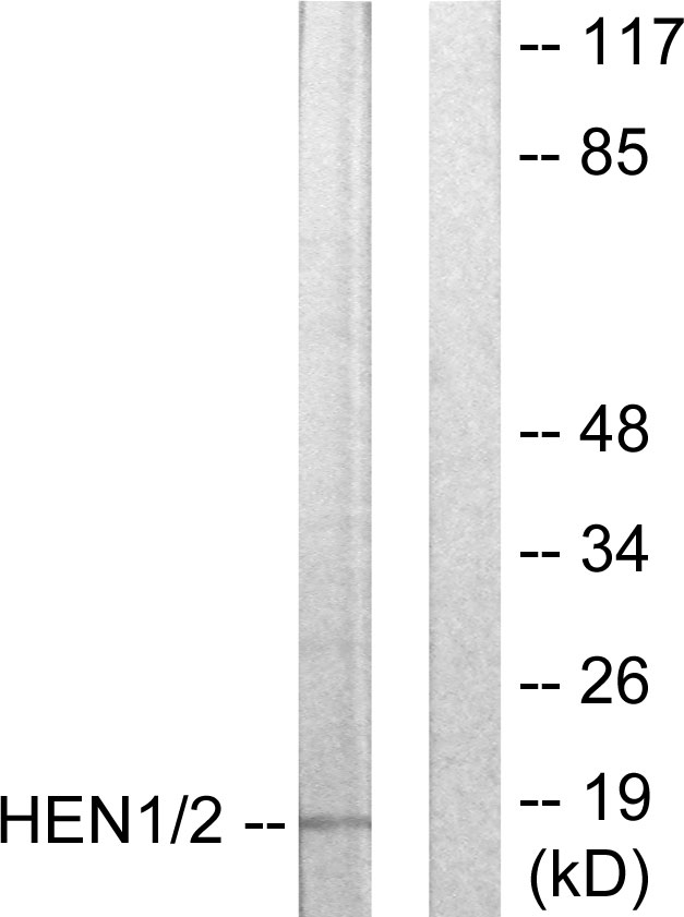 HEN1 + HEN2 Antibody - Western blot analysis of lysates from Jurkat cells, using HEN1/2 Antibody. The lane on the right is blocked with the synthesized peptide.
