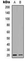 HEN1 + HEN2 Antibody - Western blot analysis of HEN1/2 expression in HEK293T (A); NIH3T3 (B) whole cell lysates.