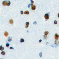 HEN1 + HEN2 Antibody - Immunohistochemical analysis of HEN1/2 staining in human brain formalin fixed paraffin embedded tissue section. The section was pre-treated using heat mediated antigen retrieval with sodium citrate buffer (pH 6.0). The section was then incubated with the antibody at room temperature and detected using an HRP conjugated compact polymer system. DAB was used as the chromogen. The section was then counterstained with hematoxylin and mounted with DPX.