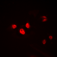 HEN1 + HEN2 Antibody - Immunofluorescent analysis of HEN1/2 staining in HEK293T cells. Formalin-fixed cells were permeabilized with 0.1% Triton X-100 in TBS for 5-10 minutes and blocked with 3% BSA-PBS for 30 minutes at room temperature. Cells were probed with the primary antibody in 3% BSA-PBS and incubated overnight at 4 deg C in a humidified chamber. Cells were washed with PBST and incubated with a DyLight 594-conjugated secondary antibody (red) in PBS at room temperature in the dark. DAPI was used to stain the cell nuclei (blue).