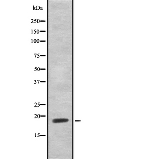 HEN1 + HEN2 Antibody - Western blot analysis of HEN1/2 using Jurkat whole cells lysates
