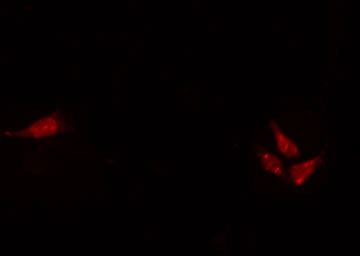 HEN1 + HEN2 Antibody - Staining HeLa cells by IF/ICC. The samples were fixed with PFA and permeabilized in 0.1% Triton X-100, then blocked in 10% serum for 45 min at 25°C. The primary antibody was diluted at 1:200 and incubated with the sample for 1 hour at 37°C. An Alexa Fluor 594 conjugated goat anti-rabbit IgG (H+L) Ab, diluted at 1/600, was used as the secondary antibody.