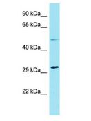 HENMT1 Antibody - HENMT1 antibody Western Blot of Jurkat. Antibody dilution: 1 ug/ml.  This image was taken for the unconjugated form of this product. Other forms have not been tested.