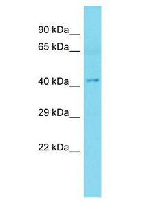 HENMT1 Antibody - HENMT1 antibody Western Blot of Fetal Liver. Antibody dilution: 1 ug/ml.  This image was taken for the unconjugated form of this product. Other forms have not been tested.