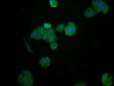 HEPACAM Antibody - Immunofluorescence staining of MCF-7 cells at a dilution of 1:200, counter-stained with DAPI. The cells were fixed in 4% formaldehyde, permeabilized using 0.2% Triton X-100 and blocked in 10% normal Goat Serum. The cells were then incubated with the antibody overnight at 4 °C.The secondary antibody was Alexa Fluor 488-congugated AffiniPure Goat Anti-Rabbit IgG (H+L) .