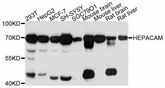 HEPACAM Antibody - Western blot analysis of extracts of various cell lines, using HEPACAM antibody at 1:3000 dilution. The secondary antibody used was an HRP Goat Anti-Rabbit IgG (H+L) at 1:10000 dilution. Lysates were loaded 25ug per lane and 3% nonfat dry milk in TBST was used for blocking. An ECL Kit was used for detection and the exposure time was 10s.