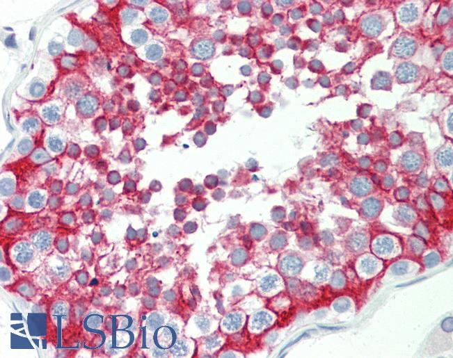HEPACAM2 Antibody - Anti-HEPACAM2 antibody IHC staining of human testis. Immunohistochemistry of formalin-fixed, paraffin-embedded tissue after heat-induced antigen retrieval. Antibody concentration 5 ug/ml.  This image was taken for the unconjugated form of this product. Other forms have not been tested.