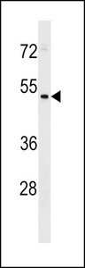 HEPACAM2 Antibody - HEPACAM2 Antibody western blot of NCI-H460 cell line lysates (35 ug/lane). The HEPACAM2 antibody detected the HEPACAM2 protein (arrow).