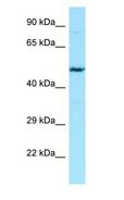 Heparanase 2 / HPSE2 Antibody - Heparanase 2 / HPSE2 antibody Western Blot of Jurkat.  This image was taken for the unconjugated form of this product. Other forms have not been tested.