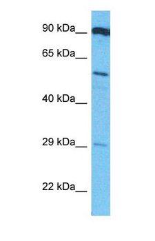 Heparanase 2 / HPSE2 Antibody - Western blot of HPSE2 Antibody with human MCF7 Whole Cell lysate.  This image was taken for the unconjugated form of this product. Other forms have not been tested.