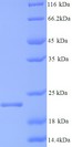 HBcAg / HBV Core Antigen Protein