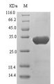 HBV X Protein Protein - (Tris-Glycine gel) Discontinuous SDS-PAGE (reduced) with 5% enrichment gel and 15% separation gel.