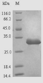PDHX / Protein X / ProX Protein - (Tris-Glycine gel) Discontinuous SDS-PAGE (reduced) with 5% enrichment gel and 15% separation gel.