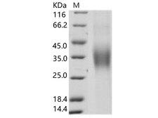 HCV E1 Protein - Recombinant HCV Envelope Glycoprotein E1 / HCV-E1 (subtype 1b, strain HC-J4) Protein (His Tag)