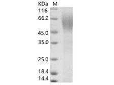 HCV E2 Protein - Recombinant HCV (serotype 1b, isolate HC-J4) Envelope / E2 Protein (His Tag)