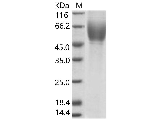 HCV E2 Protein - Recombinant HCV (serotype 1c,isolate HC-G9) E2 Protein (His Tag)